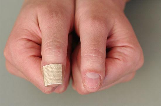 comerse las uñas
